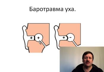 Способы выравнивания давления в полости уха